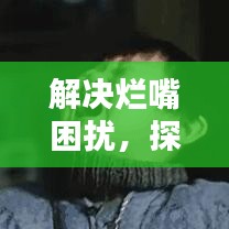 解决烂嘴困扰，探索最佳药物治疗方案