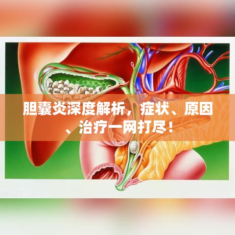 胆囊炎深度解析，症状、原因、治疗一网打尽！