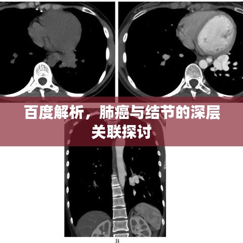 纲挈目张